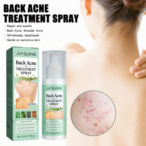 Back Acne Repair Back Shoulder Acne Desalination Acne Mark Skin Care Spray